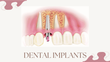 The Importance of Location: Find a Dentist Conveniently Located Near You in South Daytona